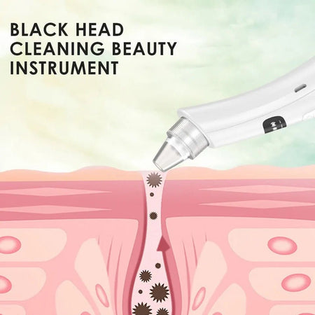 Blackhead Pore Facial Cleaning Vacuum Tool